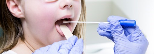 תרבית גרון (Throat Culture) - תמונה